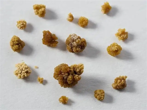 图片细节说明